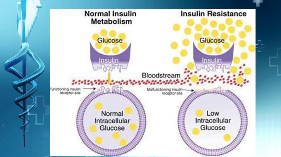 inzulinrezisztencia okai